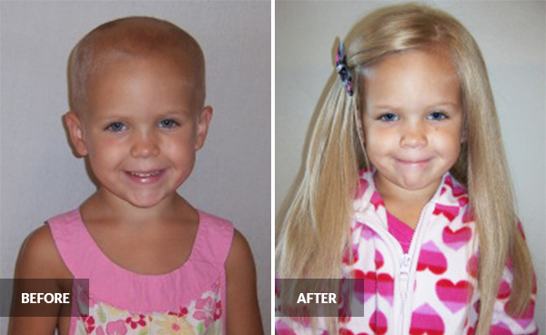 child wigs cancer